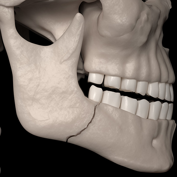 Learn about Facial Trauma