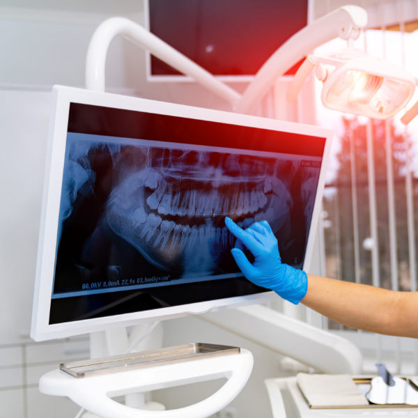 Oral surgery xray